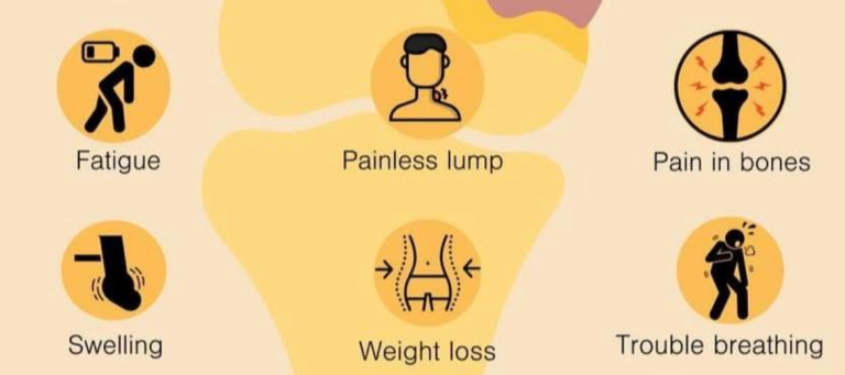 Symptoms of Sarcoma: Fatigue, Painless Lump, Pain in Bones, Swelling, Weight Loss, Trouble Breathing